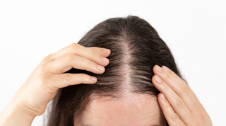 Vzroki in rešitve za izpadanje las pri ženskah