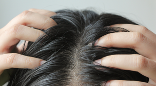 Moroccanoil nega lasišča za mastno ali neuravnoteženo lasišče