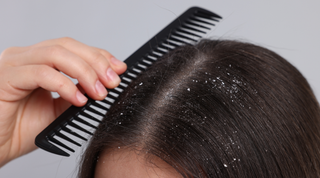 Preprečevanje prhljaja pri občutljivem lasišču